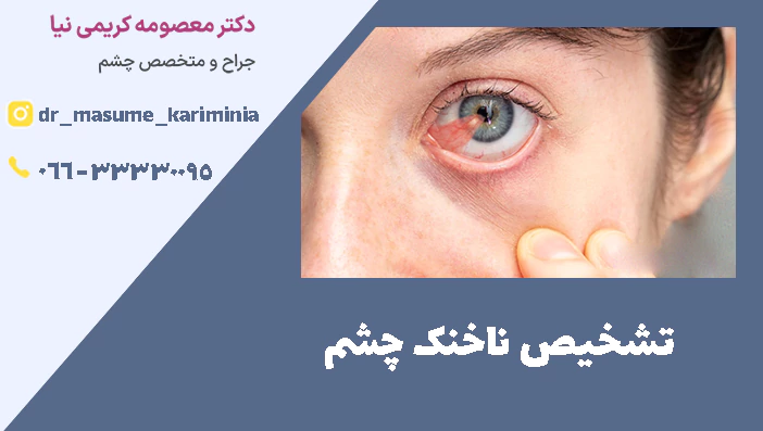 تشخیص ناخنک چشم