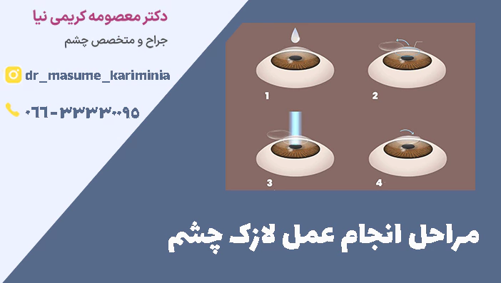 مراحل انجام عمل