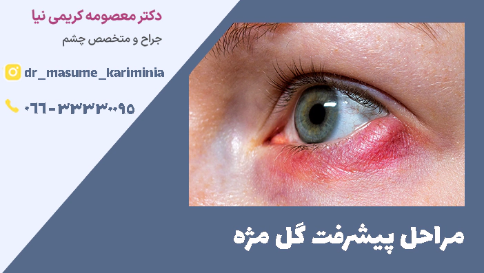 مراحل پیشرفت گل مژه