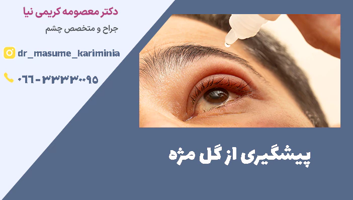 پیشگیری از گل مژه