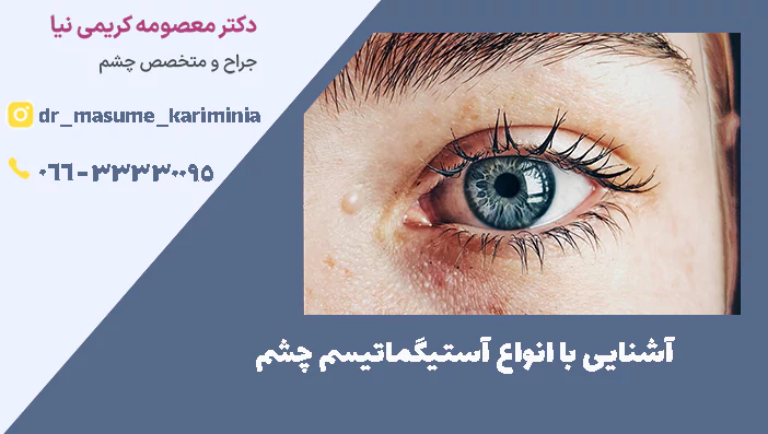 آشنایی با انواع آستیگماتیسم چشم