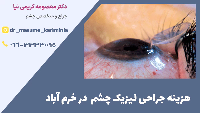 هزینه جراحی لیزیک چشم  در خرم آباد