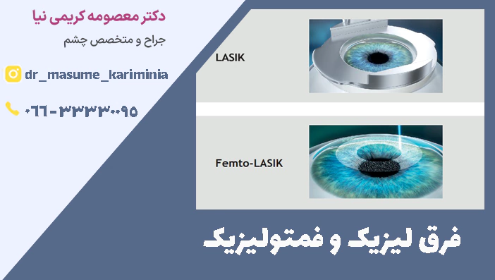 فرق لیزیک و فمتولیزیک