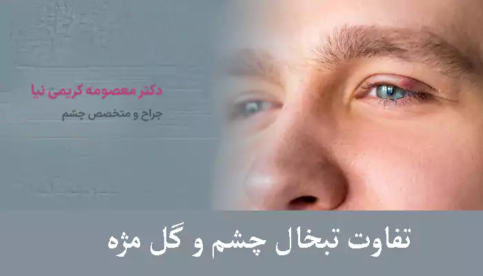 تفاوت تبخال چشم و گل مژه