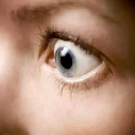آستیگماتیسم چشم چیست؟